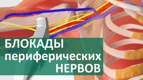 Блокада под контролем