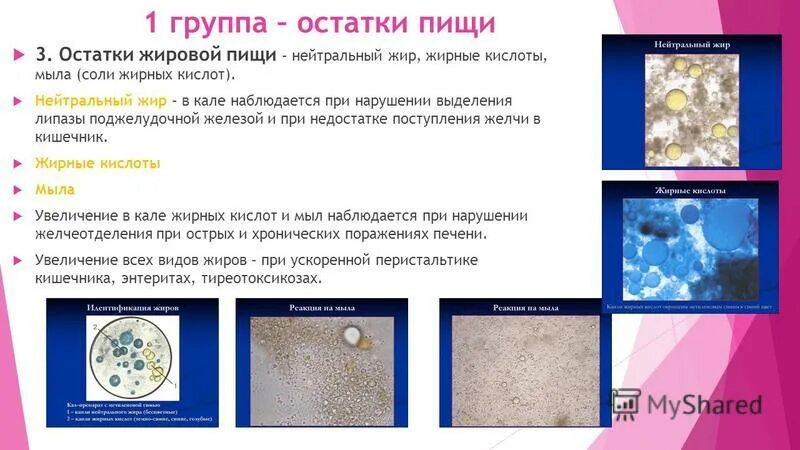 Микроскопия кала соединительная ткань. Кристаллы жирных кислот микроскопия кала. Нейтральный жир в копрограмме. Нейтральный жир в копрограмме. Копрограмма нейтральный жир.
