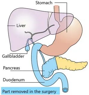 Gallbladder formula