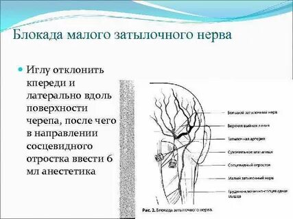 Невралгия затылочного нерва симптомы и лечение