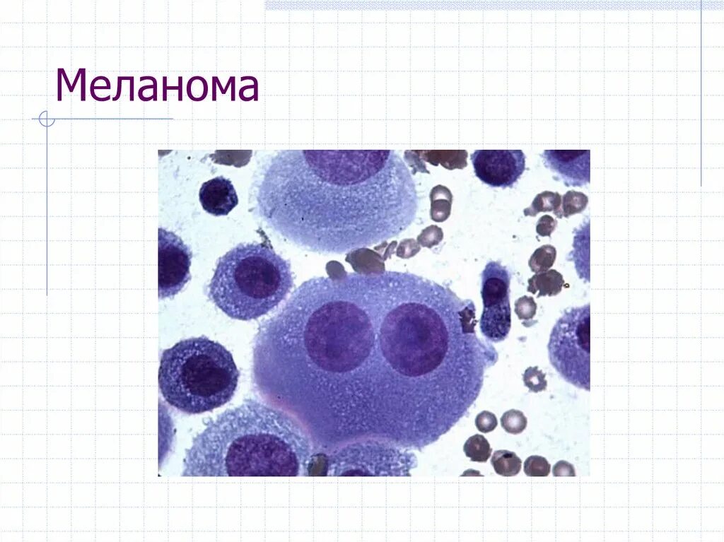 Вирус барра мазок