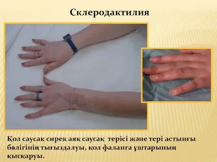 Порнодағы гитара фигурасы