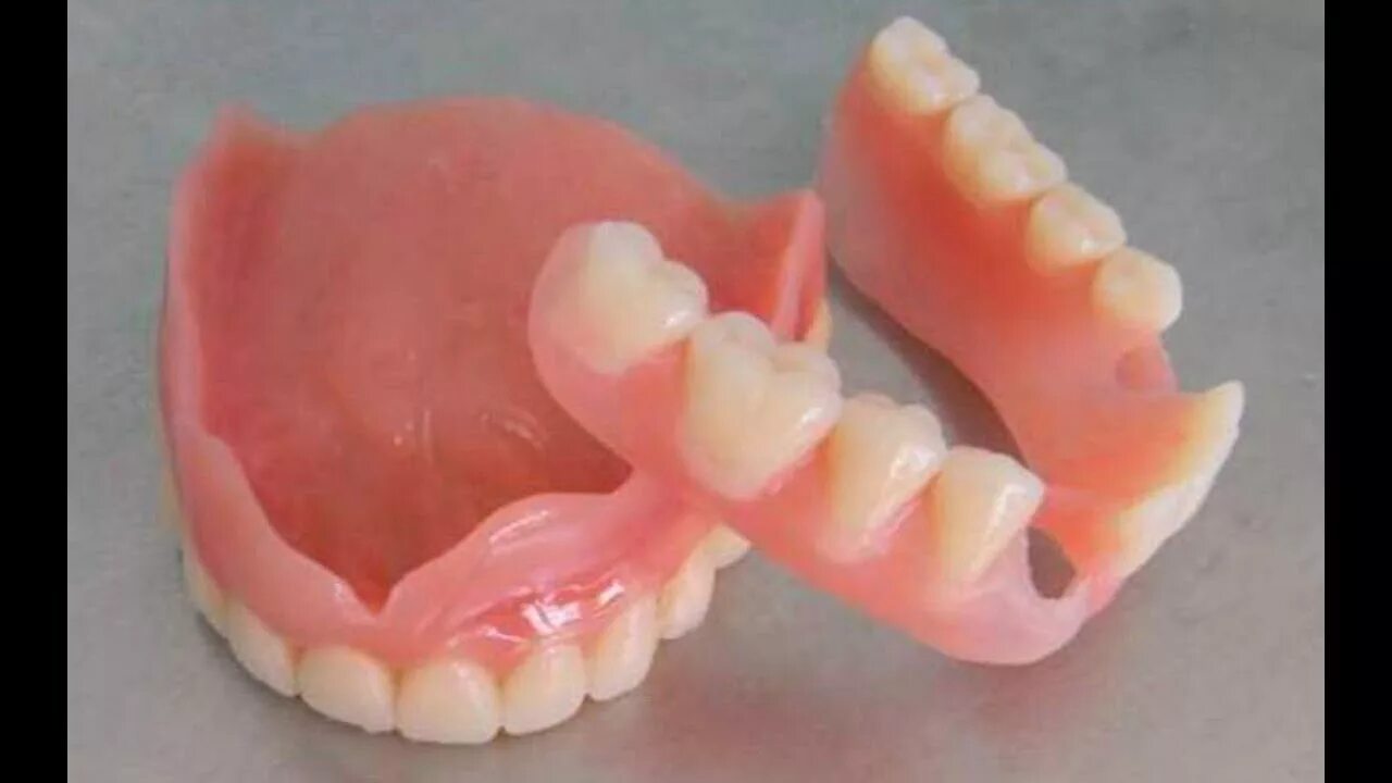 Частичный съемный протез Flexi n512. Пластинчатый микропротез. Съемный протез (6-14 зубов) термо Джет. Бюгельный протез силиконовый.