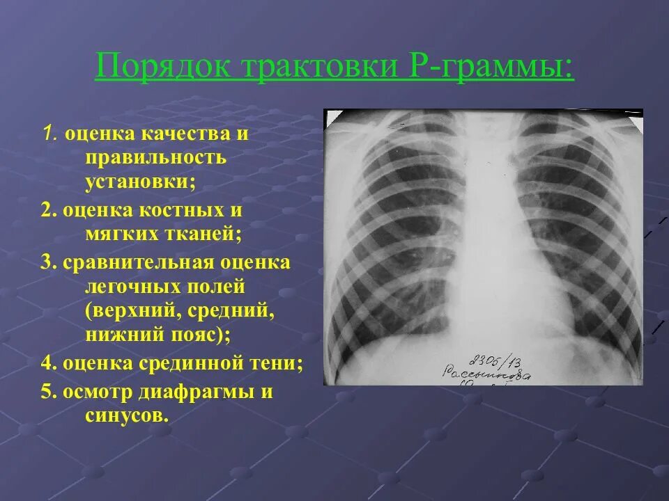 Лучевые заболевания легких. Лучевая диагностика заболеваний легких. Рентгенодиагностика заболеваний легких. Заболевания легких рентгенология. Рентгенодиагностика воспалительных заболеваний легких.