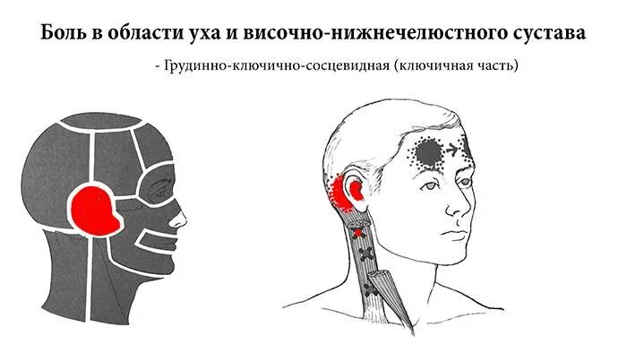 Болит левый затылок. Болит голова лоб. Головная боль во лбу. Схема локализации головной боли.