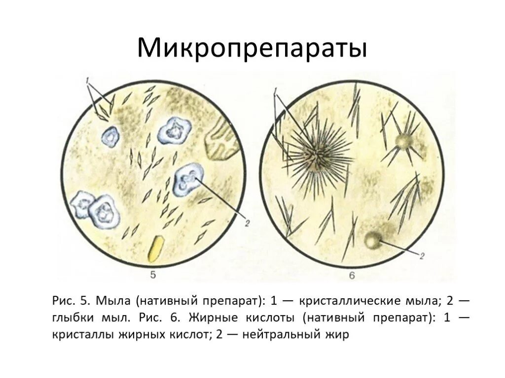 Растительная клетчатка в копрограмме. Микроскопия кала атлас копрология. Микроскопия кала клетчатка. Микроскопия кала мышечные волокна. Микроскопия кала соединительная ткань.