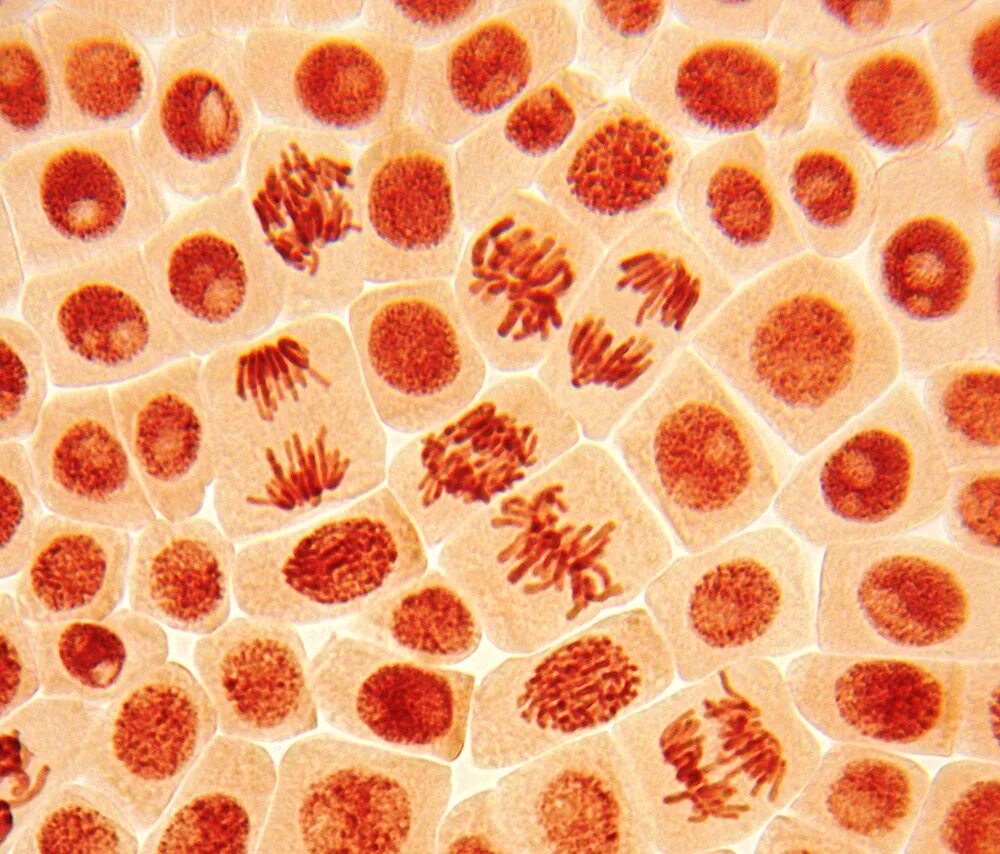 Клетки печени мыши. Митоз микрофотография. Кариокинез гистология. Митоз в микроскопе. Мейоз микрофотографии.
