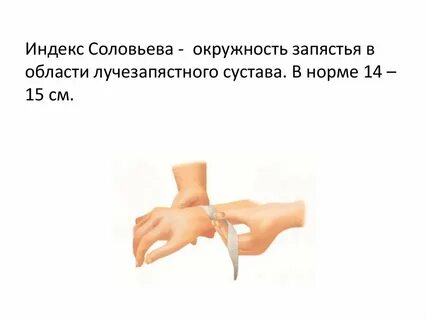 Размер таза индекс соловьевой