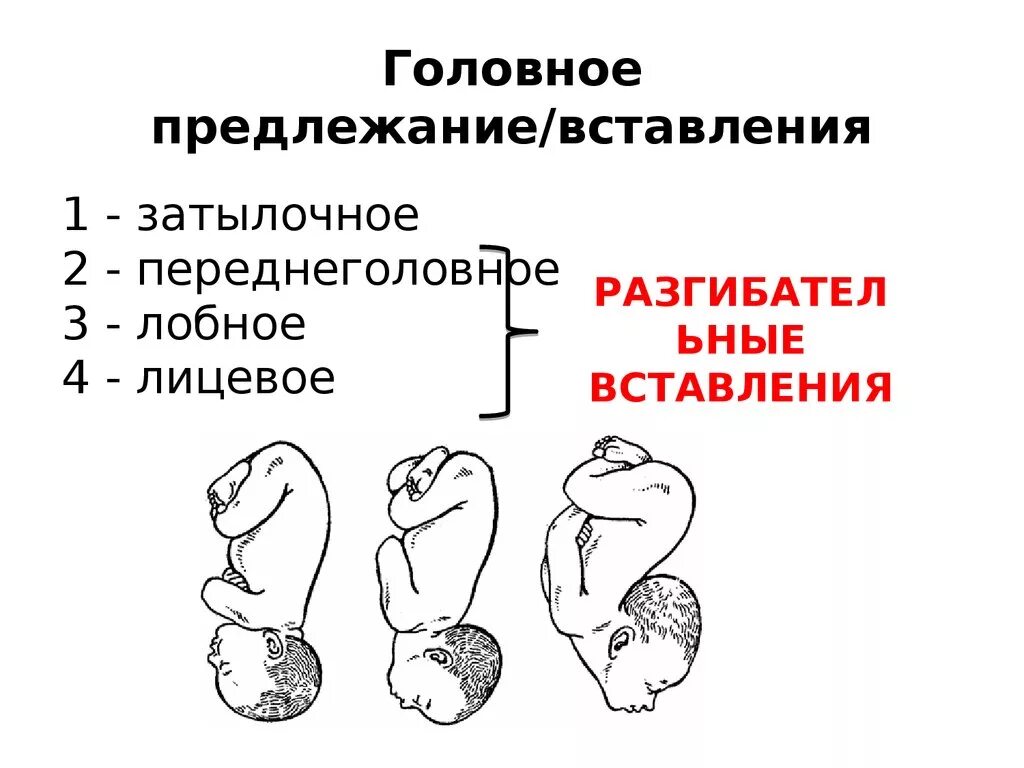 Самопроизвольное предлежание. Головное предлежание плода задний вид. Лобно затылочное предлежание плода. Головное предлежание затылочное вставление. Передний вид затылочного предлежания.