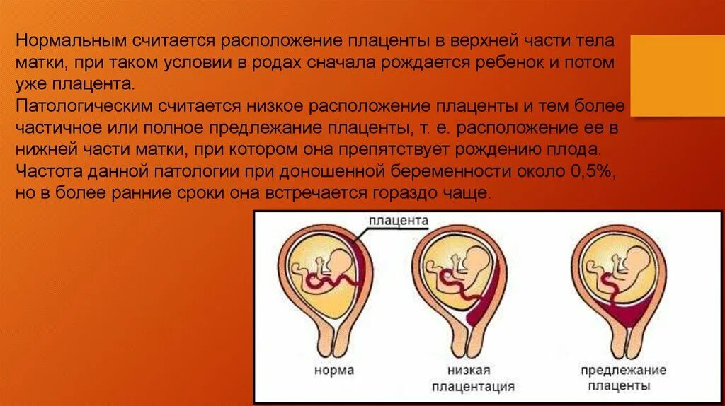 При низкой плацентации можно. Предлежание плаценты при беременности 12 недель. Нормальное расположение плаценты. Нормальное прикрепление плаценты. Низкое расположение плаценты.