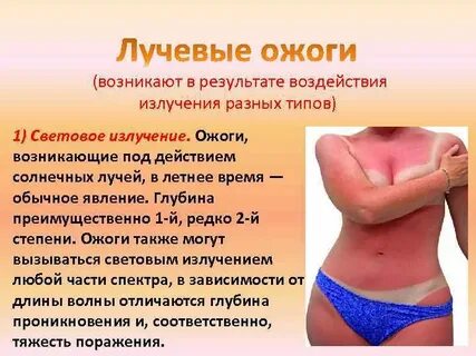 Световой ожог