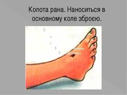 Нога коля