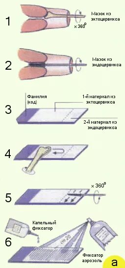 Как делают цитологию. Техника взятия мазка на цитологию. методика забора мазка на флору гинекология. взятие мазка в гинекологии алгоритм. забор гинекологических мазков алгоритм.