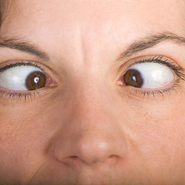 Интересные факты о б человеческом носе. Нос. Вижу переносицу. Скосить глаза к носу. Красивые косые глаза.