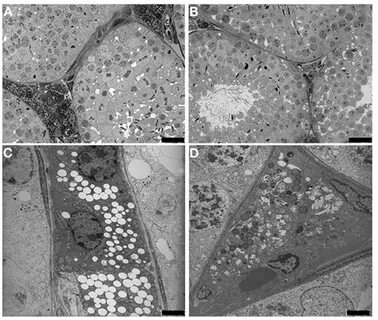 Transmission microscopy