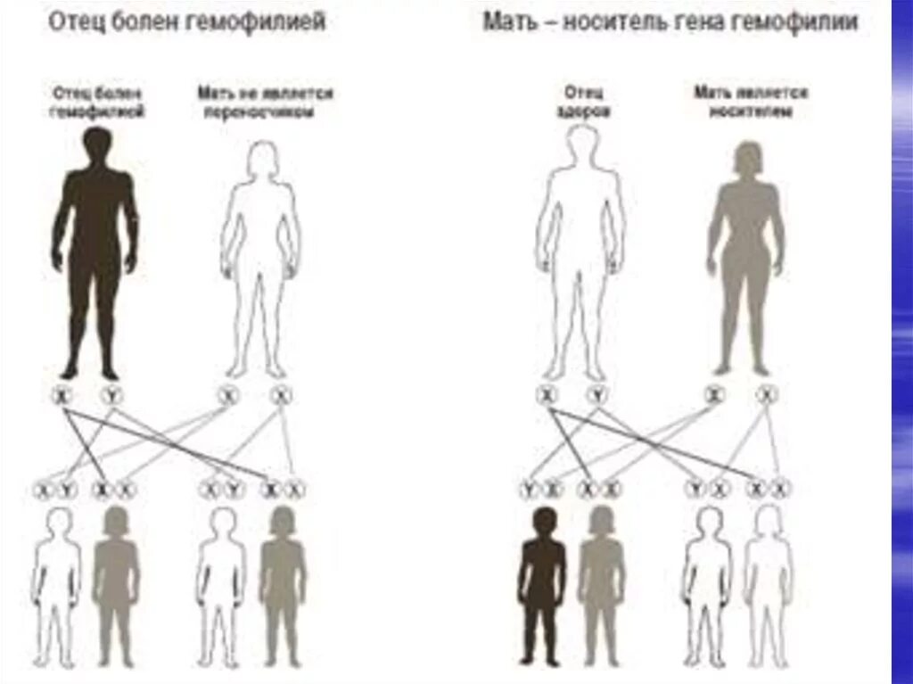 Болеют ли женщины гемофилией. Женщины носители Гена гемофилии. У матери не являющиеся носителями гемофилии