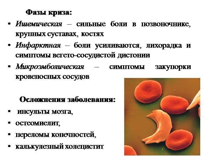 Серповидноклеточная анемия какая. Серповидноклеточная анемия у детей клиника. Серповидно клеточная анемия клиника. Серповидноклеточная анемия этиология. Серповидноклеточная анемия плейотропия.