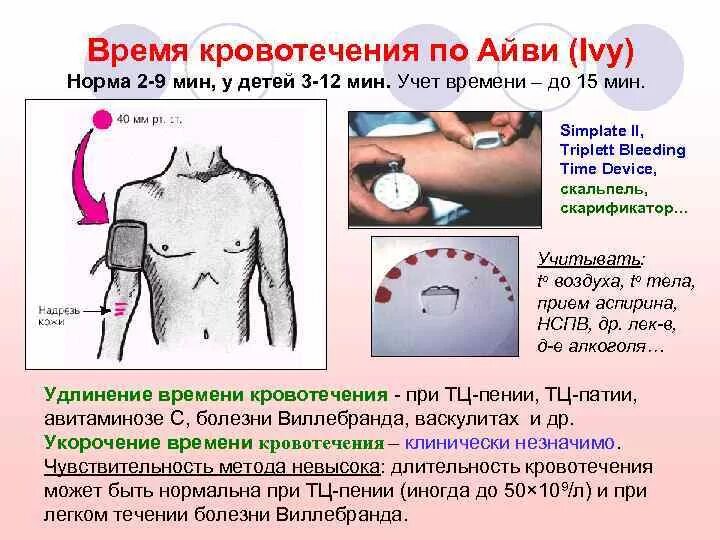 Кровь на длительность кровотечения. Длительность кровотечения по Дуке норма. Норма кровотечения по Дьюку. Продолжительность кровотечения по Дьюку. Определение кровотечения по Дюку.