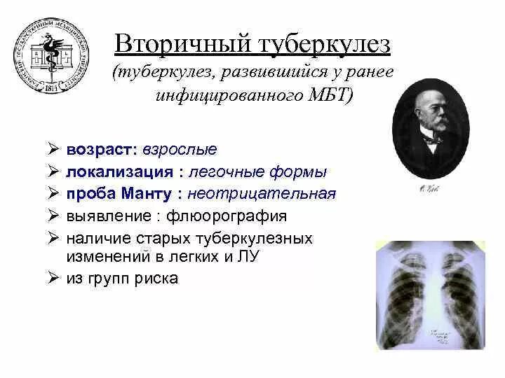 Первичные и вторичные формы туберкулеза. Формы вторичного туберкулеза. Вторичный легочный туберкулез.