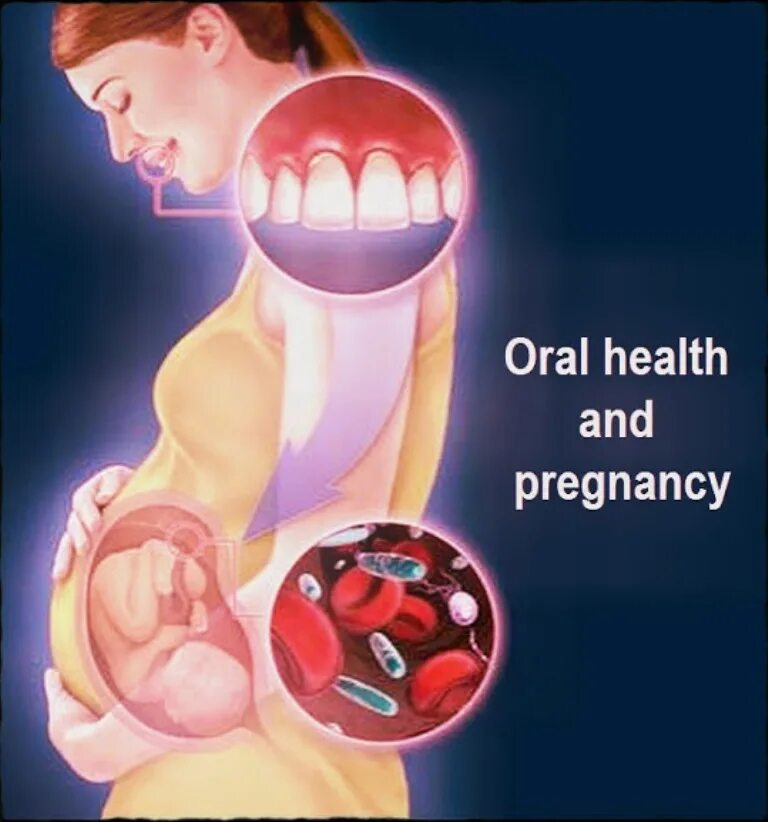 Забеременела через рот. Стоматология при беременности. Беременные и зубы. Беременность и зубы рисунок.