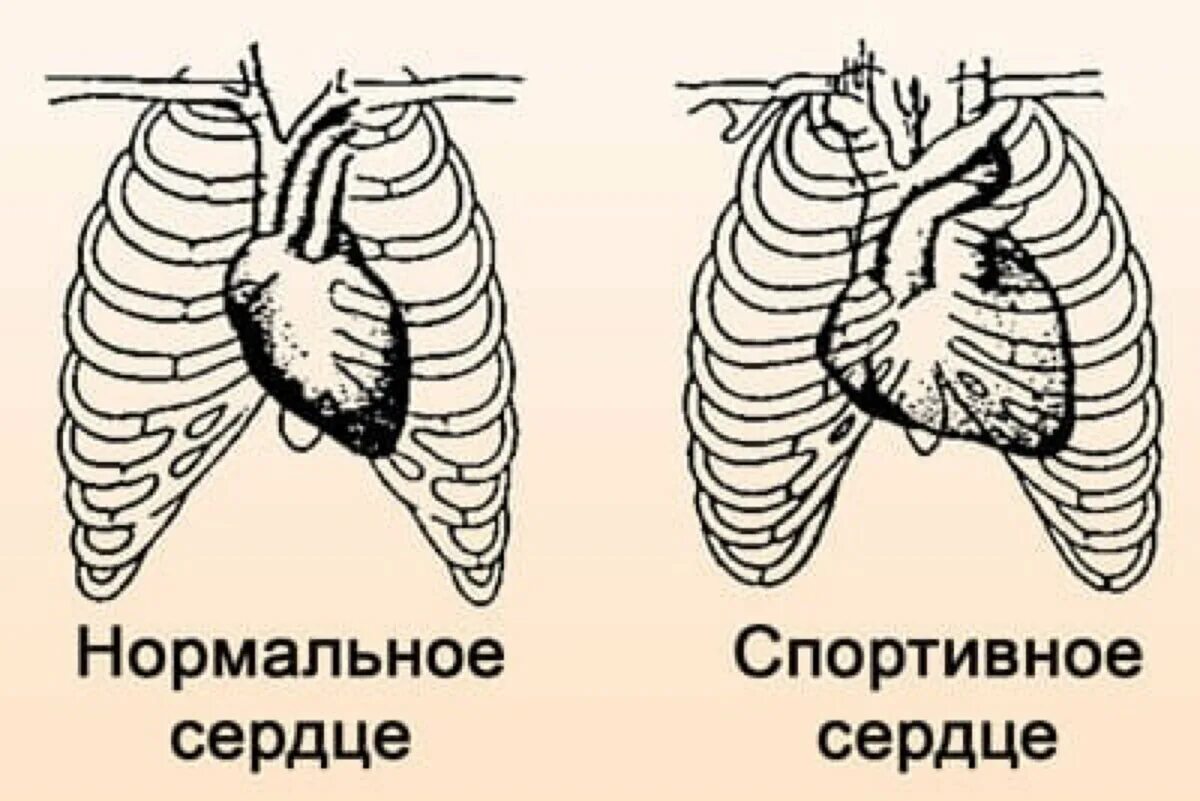 Работа сердца тренированного и нетренированного человека. Сердце тренированного и нетренированного человека. сердце спортсмена и обычного человека. сердце обычного человека. сердце треннированого и нетринероваанного еловека.