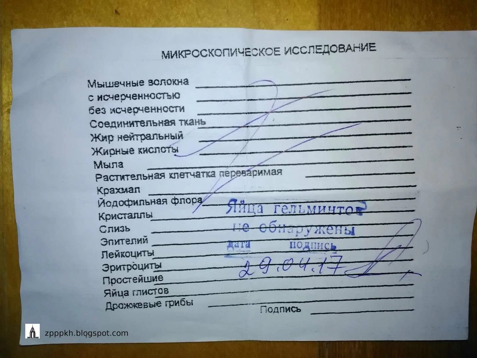 Анализ червя. Анализ на яйца глистов. Исследование кала на яйцеглист. Кал на яйца глистов направление на исследование. Результаты исследования кала на яйца глист.