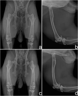 Ligamentum teres reconstruction using autogenous semitendinosus tendon with togg