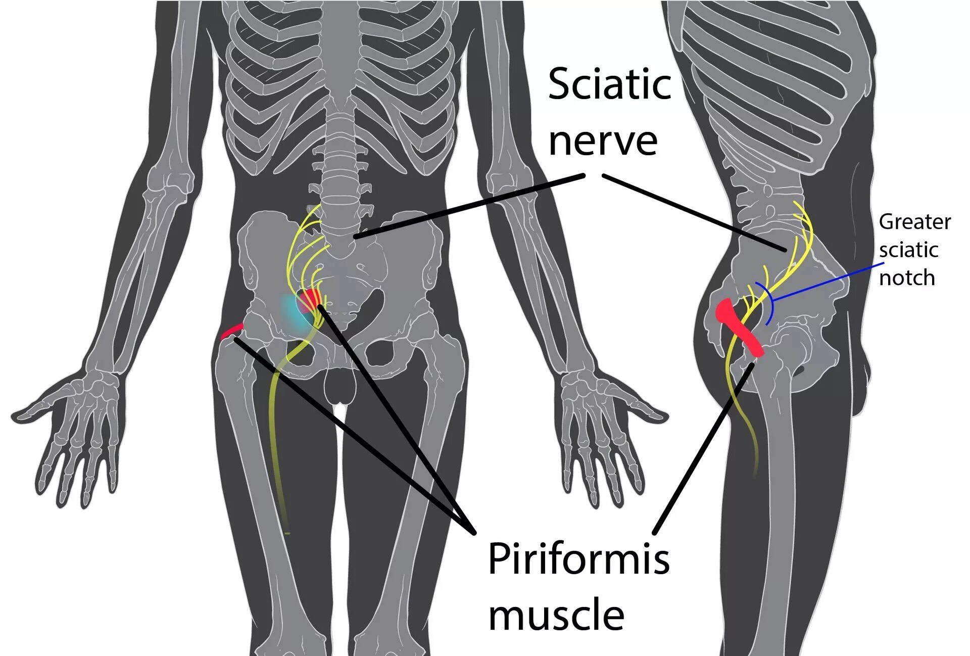 Грушевидная и седалищный нерв. Седалищный нерв (sciatic nerve)?. Седалищный нерв (sciatic nerve)? 011. Седалищный нерв анатомия мышцы. Поясницы отдающая в пах