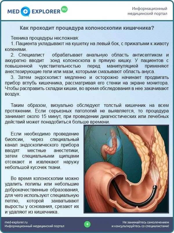 Прямая кишка колоноскопия. Метеоризм. Кишечные колики.. Спастическое сокращение кишечника.