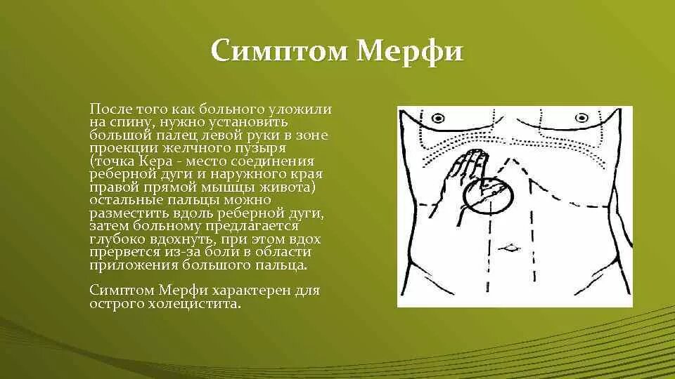 Симптом Ортнера Кера Мюсси Мерфи. Симптомы Кера Мерфи Ортнера. Симптомы Мюсси-Георгиевского, Ортнера, Образцова-Мерфи. Положительные симптомы Кера, мэрфи, Ортнера.