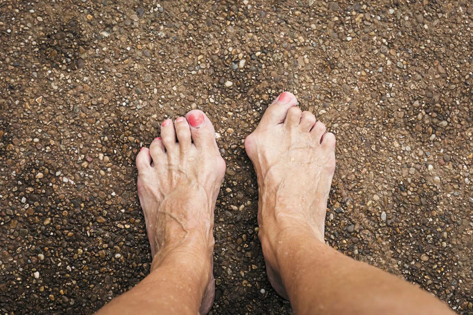 Big toe