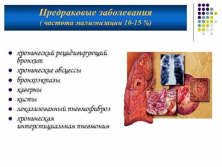 Профилактика предраковых заболеваний