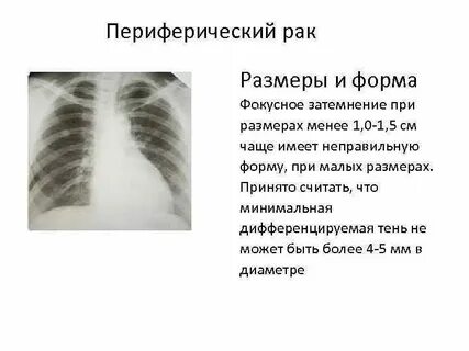 Затемнение неправильной формы