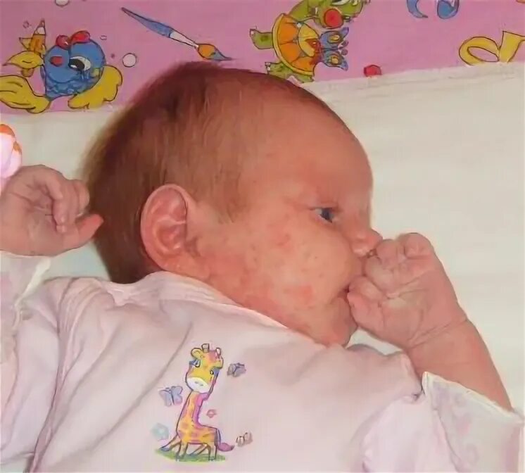 Записи Мария в сообществе Здоровье будущей мамы