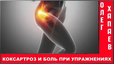 Боли при коксартрозе
