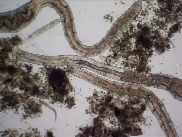 Активный червь. Малощетинковые черви активного ила. Aelosoma Малощетинковые черви. Малощетинковый червь в активном иле. Червячки в активном иле.