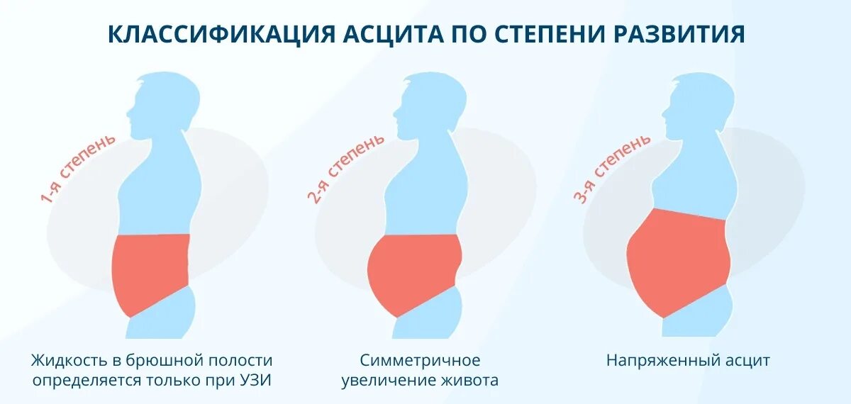 После операции собралась жидкость. Живот при цероза печени.