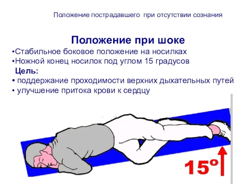 Головокружение при смене положения тела лежа