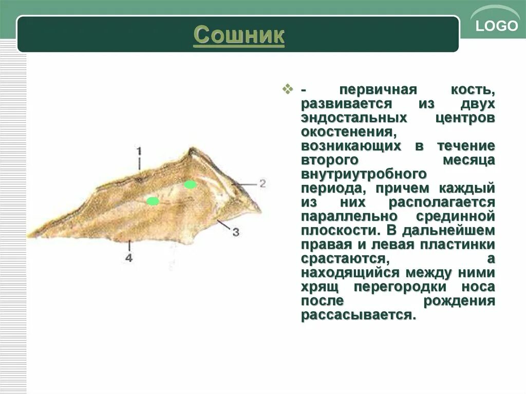 Сошник кость. Сошник у рыб. Сошник в черепе.