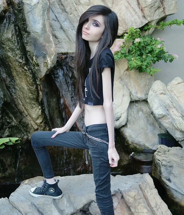 Эмо тощие. Eugenia cooney. eugenia cooney анорексия. eugenia cooney в купальнике. худой эмо.