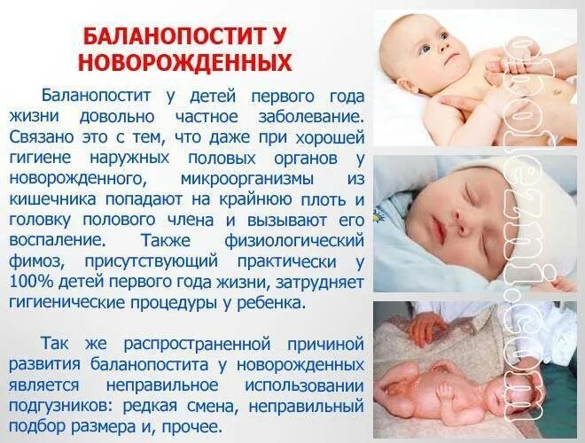 У ребенка под крайней плотью. Воспаление крайней плоти у ребенка. баланопостит у детей новорожденных. баланопостит у детей мальчика.