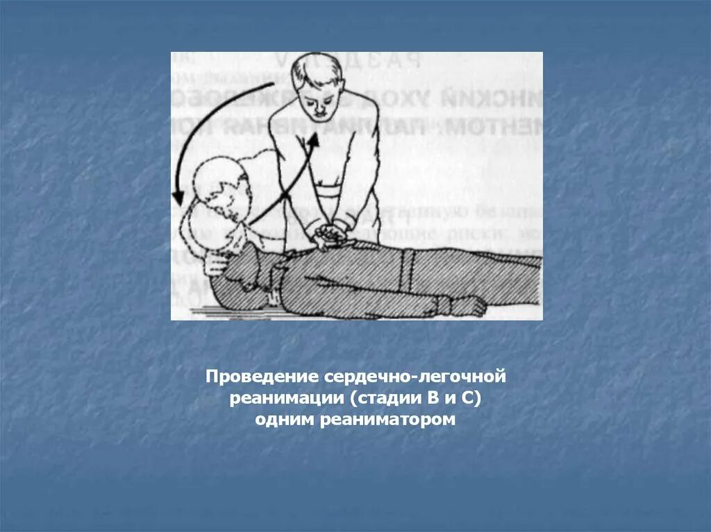 Слр 2 спасателями соотношение. Проведение слр 1 реаниматором. Ивл и непрямой массаж сердца алгоритм. Сердечно легочная реанимация 1 человеком. Непрямой массаж сердца и ивл детям.
