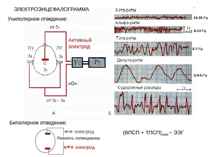 Регистрация ээг