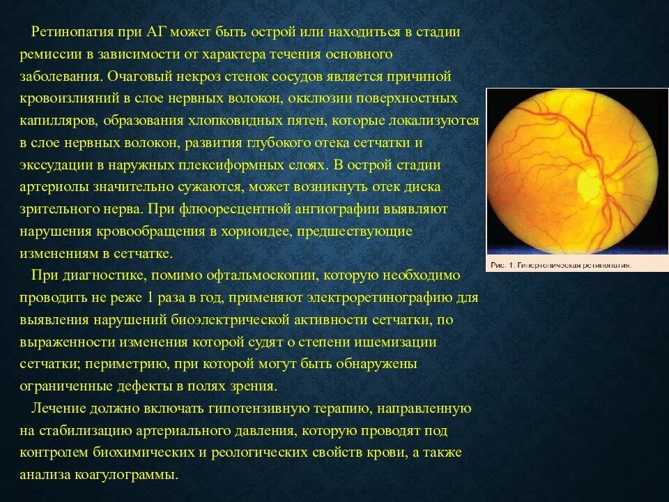 Больная сетчатка. Заболевания зрительного нерва. сетчатка и зрительный нерв. патология зрительного нерва презентация.