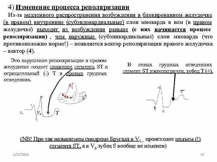 Снижение процессов реполяризации. Реполяризация миокарда желудочков экг. нарушение процессов реполяризации в миокарде. неспецифические процессы реполяризации на экг. неспецифические нарушения процессов реполяризации.