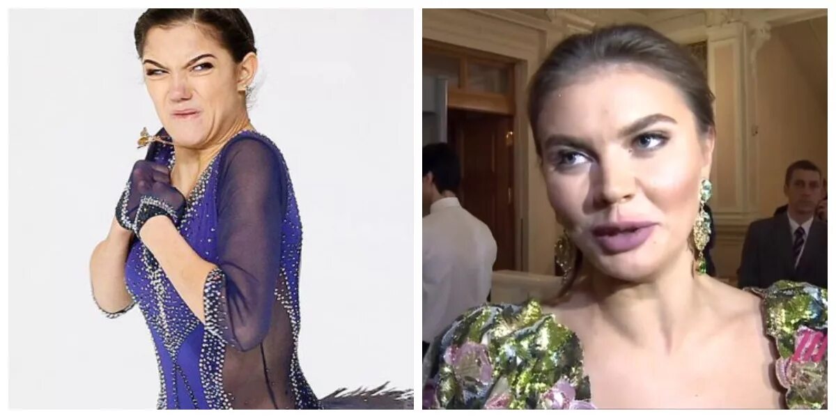 алина кабаева 2018. кабаева аверина. кабаева сделала пластику. алина кабаева после пластики. кабаева сделала пластику.