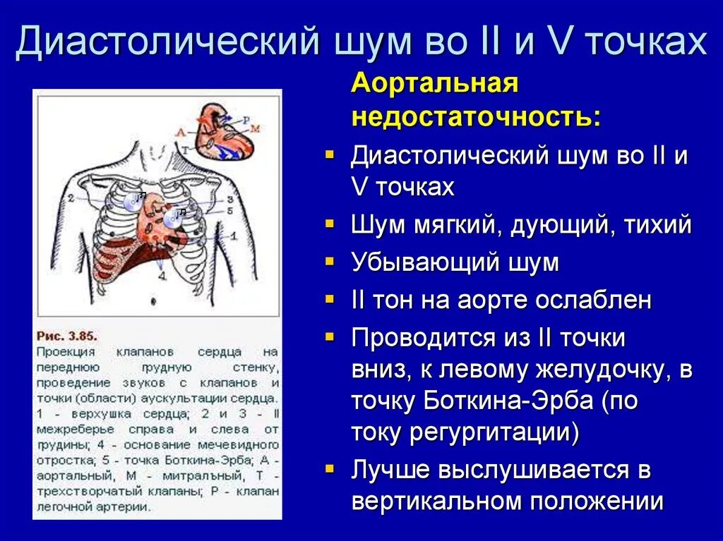 Систолический шум на верхушке сердца. Систолический шум на верхушке и в точке Боткина. Диастолический шум на верхушке. Систолический шум на верхушке сердца аускультативно выслушивается. Систолический шум это