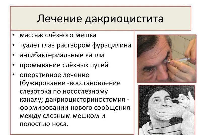 Массаж глаз слезного канала. Воспаление слезного мешка лечение. Воспаление слезного мешка у ребенка. Воспаление слезного канала у взрослых. Воспаление слезного мешка у взрослого.