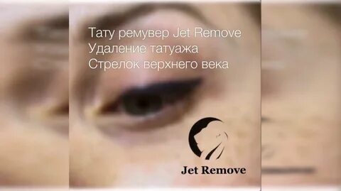 Удаление стрелок отзывы
