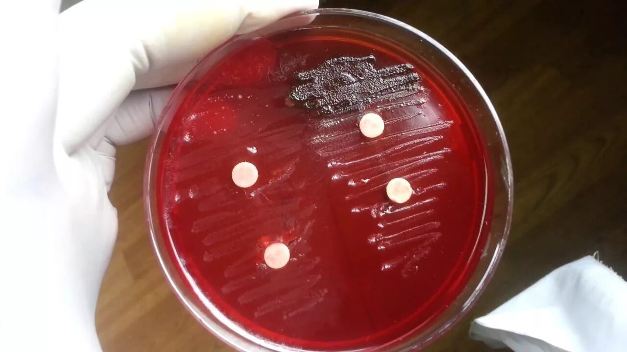 Peptostreptococcus spp